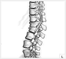 腰椎3D画像（側面像）