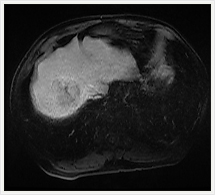 ダイナミック平衡相