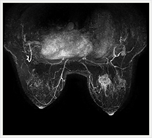 ダイナミック3相目