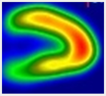 長軸垂直断層像