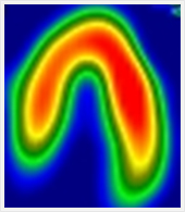 長軸水平断層像