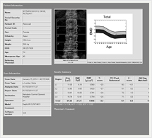 骨密度測定結果（腰椎）