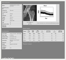 骨密度測定結果（股関節）