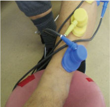 電気治療から低周波電気治療の様子