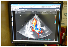 心臓超音波検査の様子