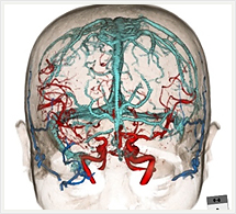 脳血管動静脈+皮膚表面