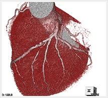 冠状動脈
アンギオグラフィックビュー